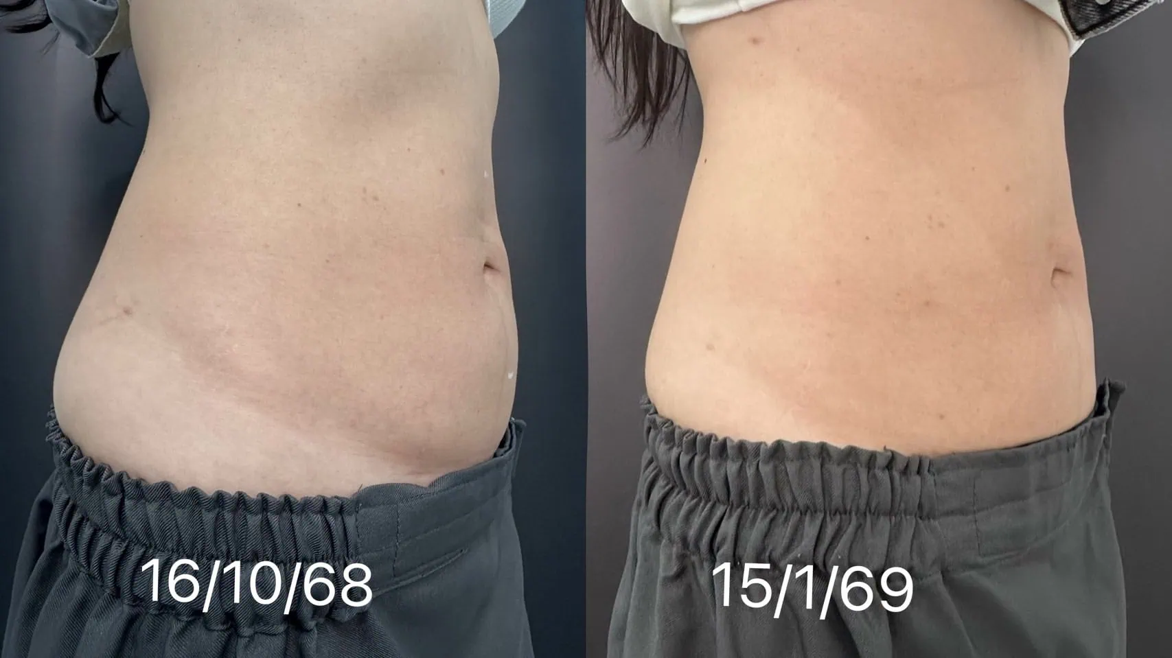 Skin quality result