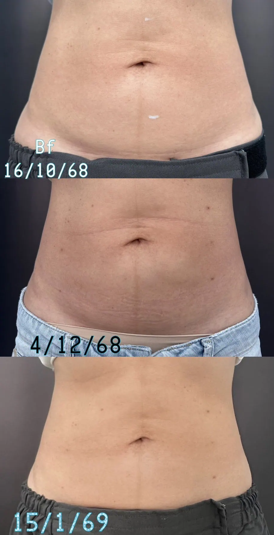 Skin quality result